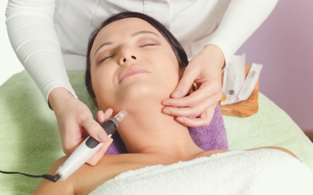 What is Microneedling and How Does It Work?