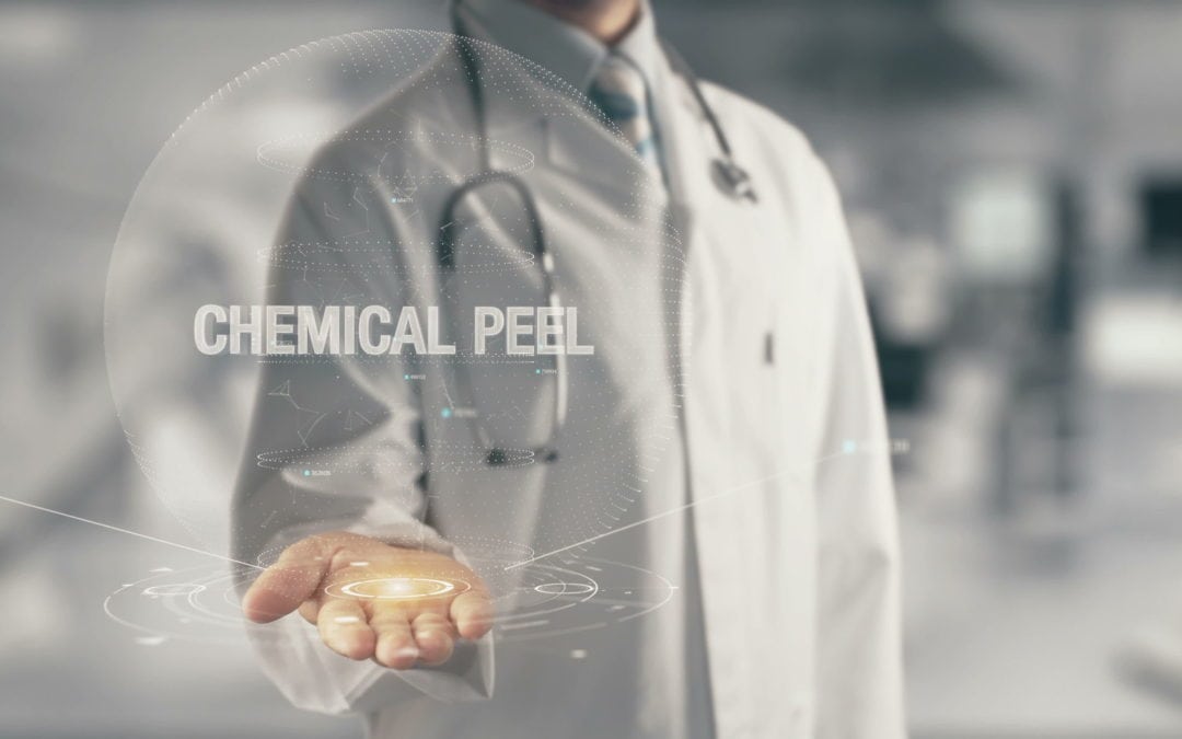 Chemical Peel – What to Expect and What to Do After
